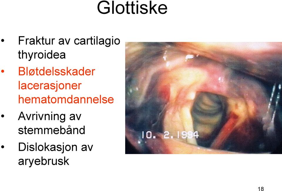 lacerasjoner hematomdannelse