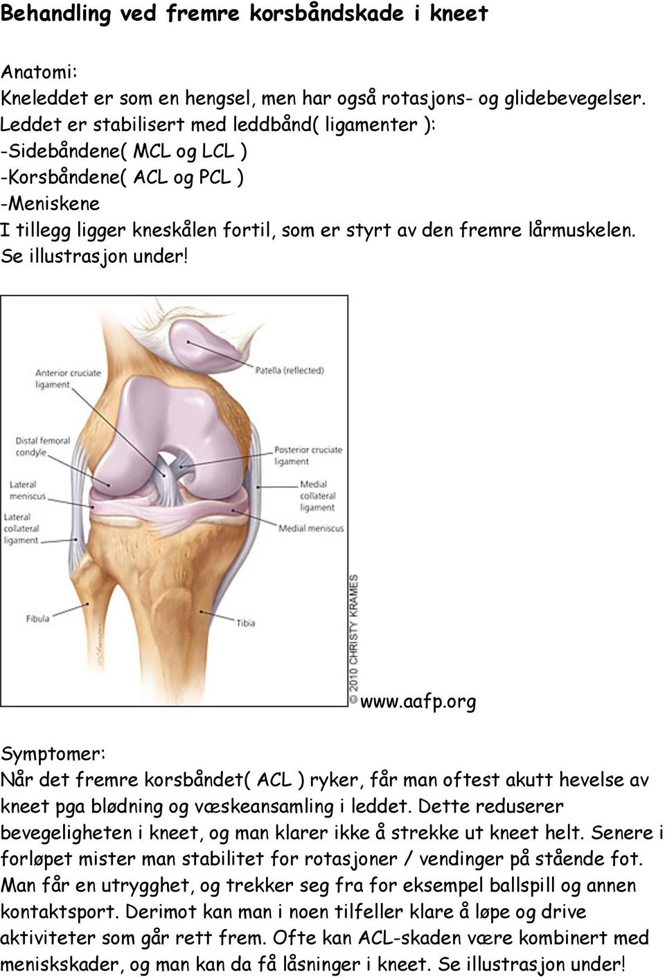 Se illustrasjon under! www.aafp.org Symptomer: Når det fremre korsbåndet( ACL ) ryker, får man oftest akutt hevelse av kneet pga blødning og væskeansamling i leddet.