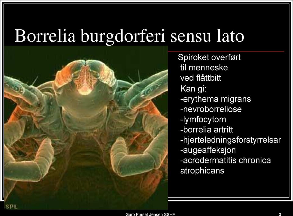 -nevroborreliose -lymfocytom -borrelia artritt