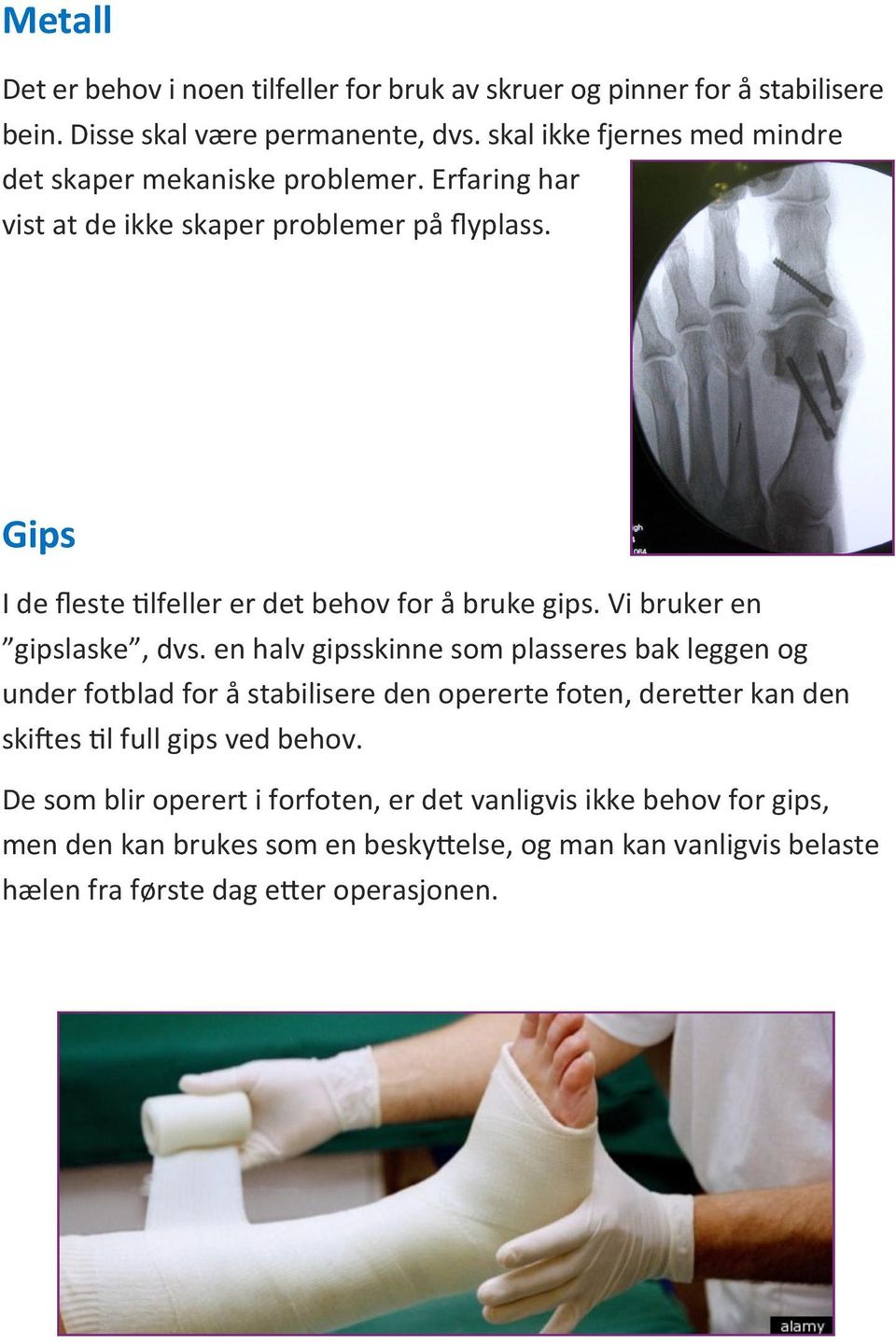 Gips I de fleste tilfeller er det behov for å bruke gips. Vi bruker en gipslaske, dvs.