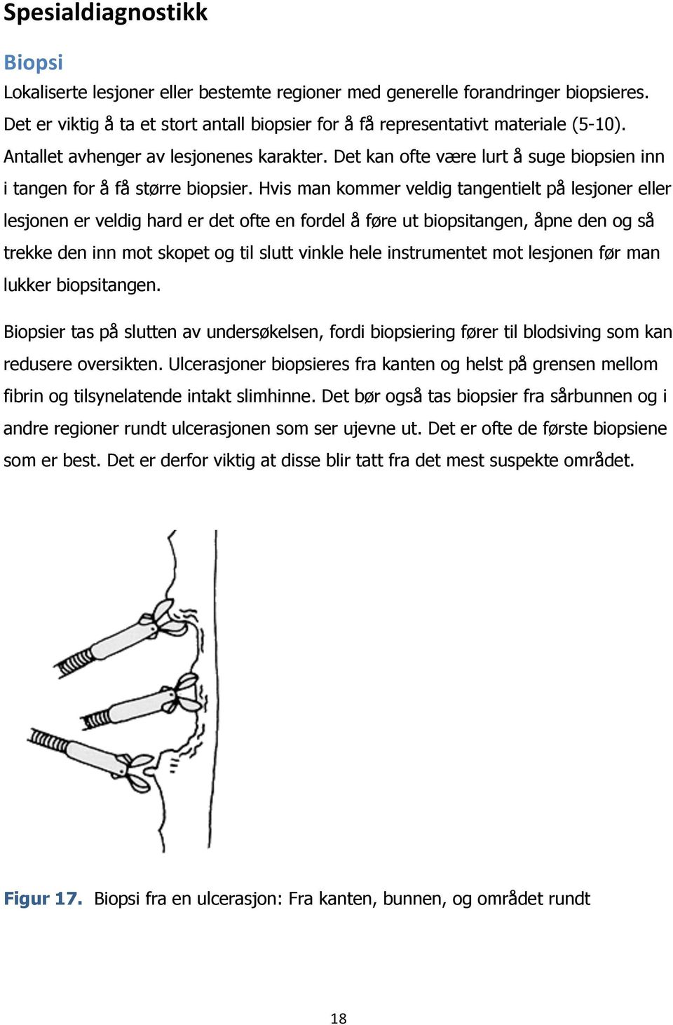 Hvis man kommer veldig tangentielt på lesjoner eller lesjonen er veldig hard er det ofte en fordel å føre ut biopsitangen, åpne den og så trekke den inn mot skopet og til slutt vinkle hele