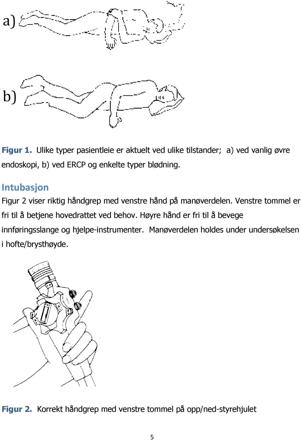 blødning. Intubasjon Figur 2 viser riktig håndgrep med venstre hånd på manøverdelen.