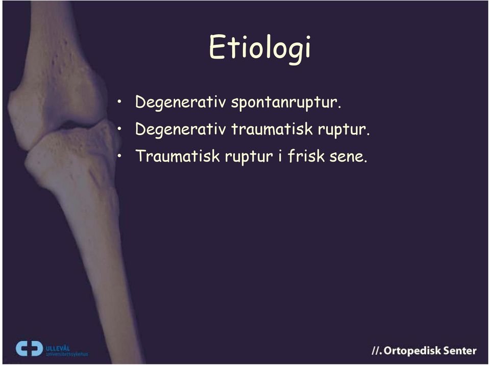 Degenerativ traumatisk