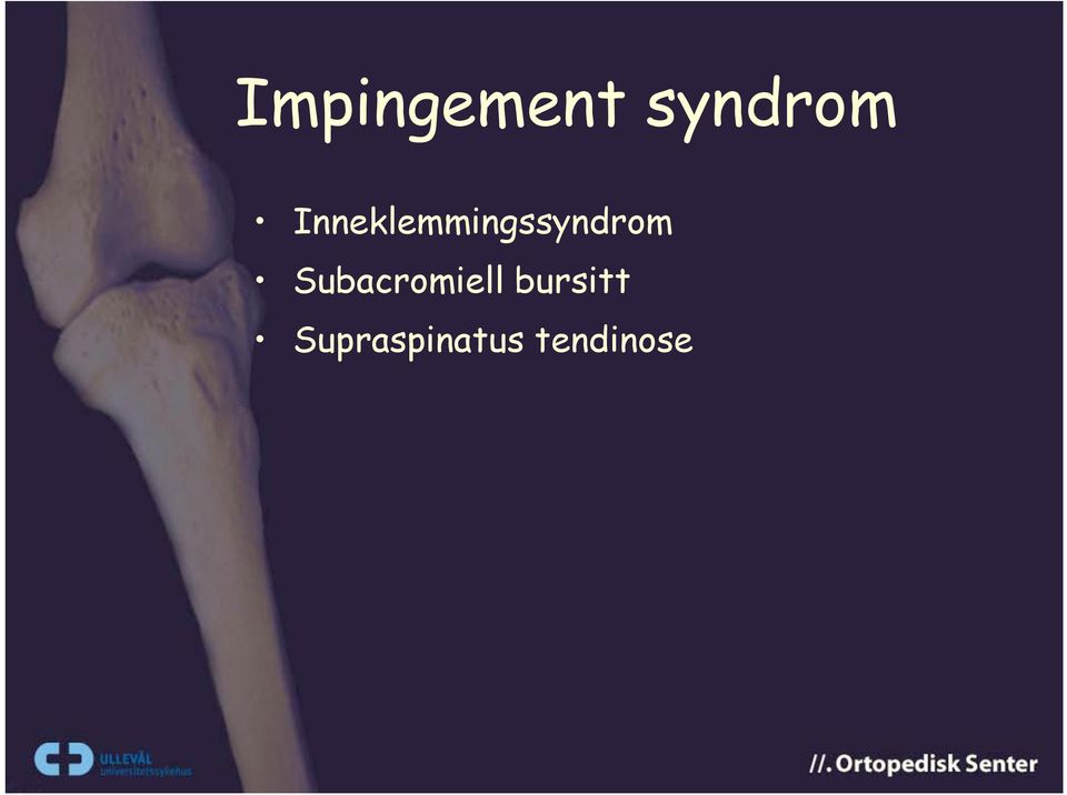 Subacromiell bursitt