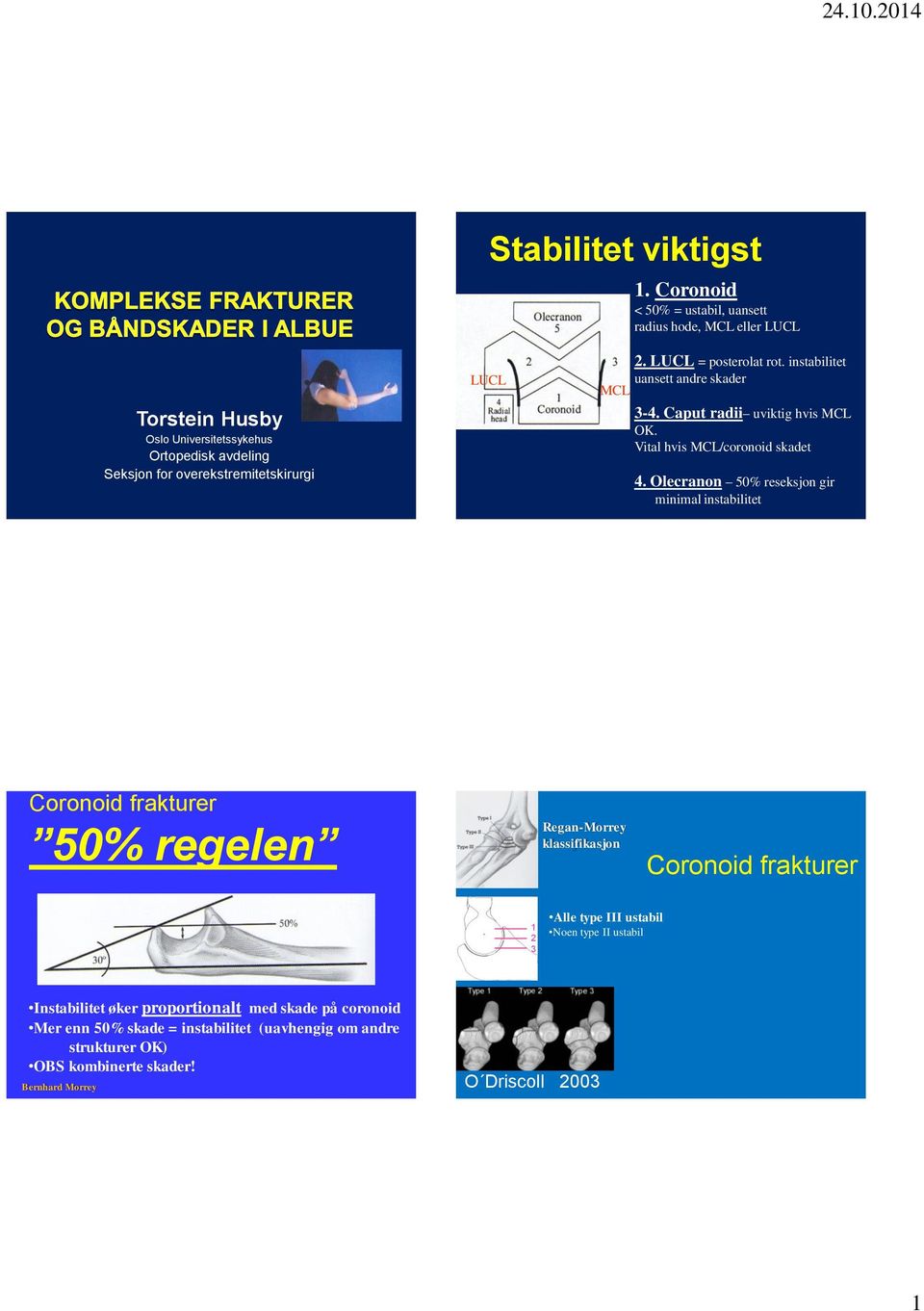 LUCL = posterolat rot. instabilitet uansett andre skader MCL 3-4. Caput radii uviktig hvis MCL OK. Vital hvis MCL/coronoid skadet 4.