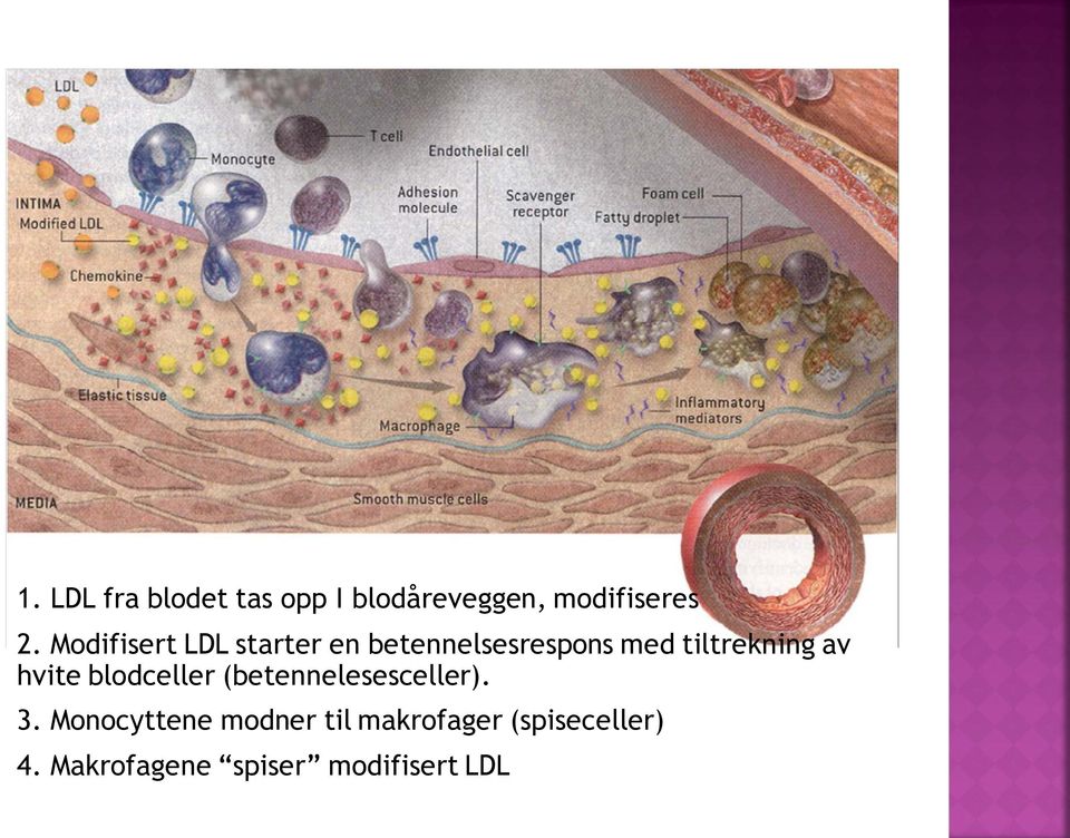 av hvite blodceller (betennelesesceller). 3.