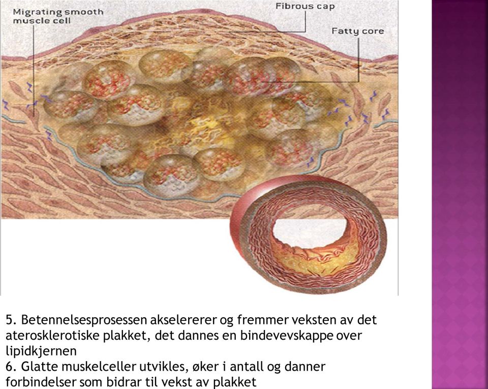 over lipidkjernen 6.