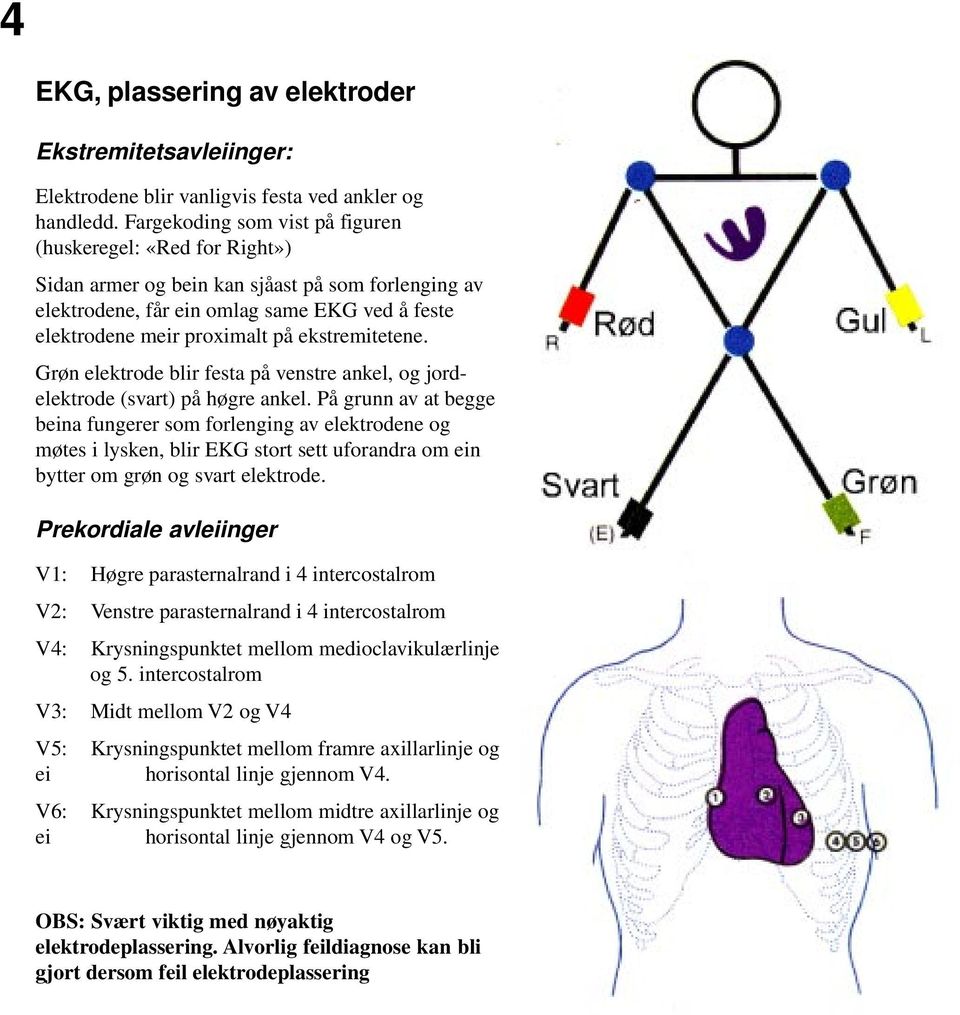 ekstremitetene. Grøn elektrode blir festa på venstre ankel, og jordelektrode (svart) på høgre ankel.