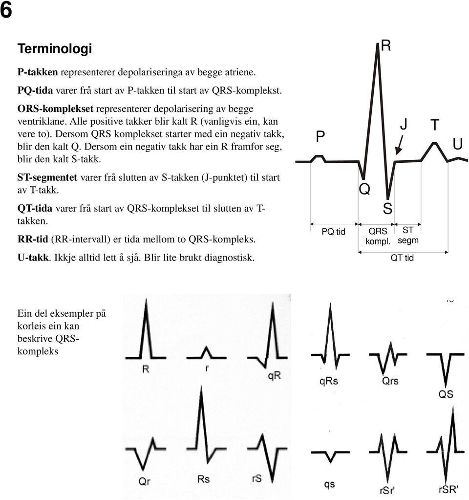 EKG. Det normale EKG, greinblokk, hypertrofi og hjarteinfarkt. Av Terje  Skjærpe - PDF Free Download