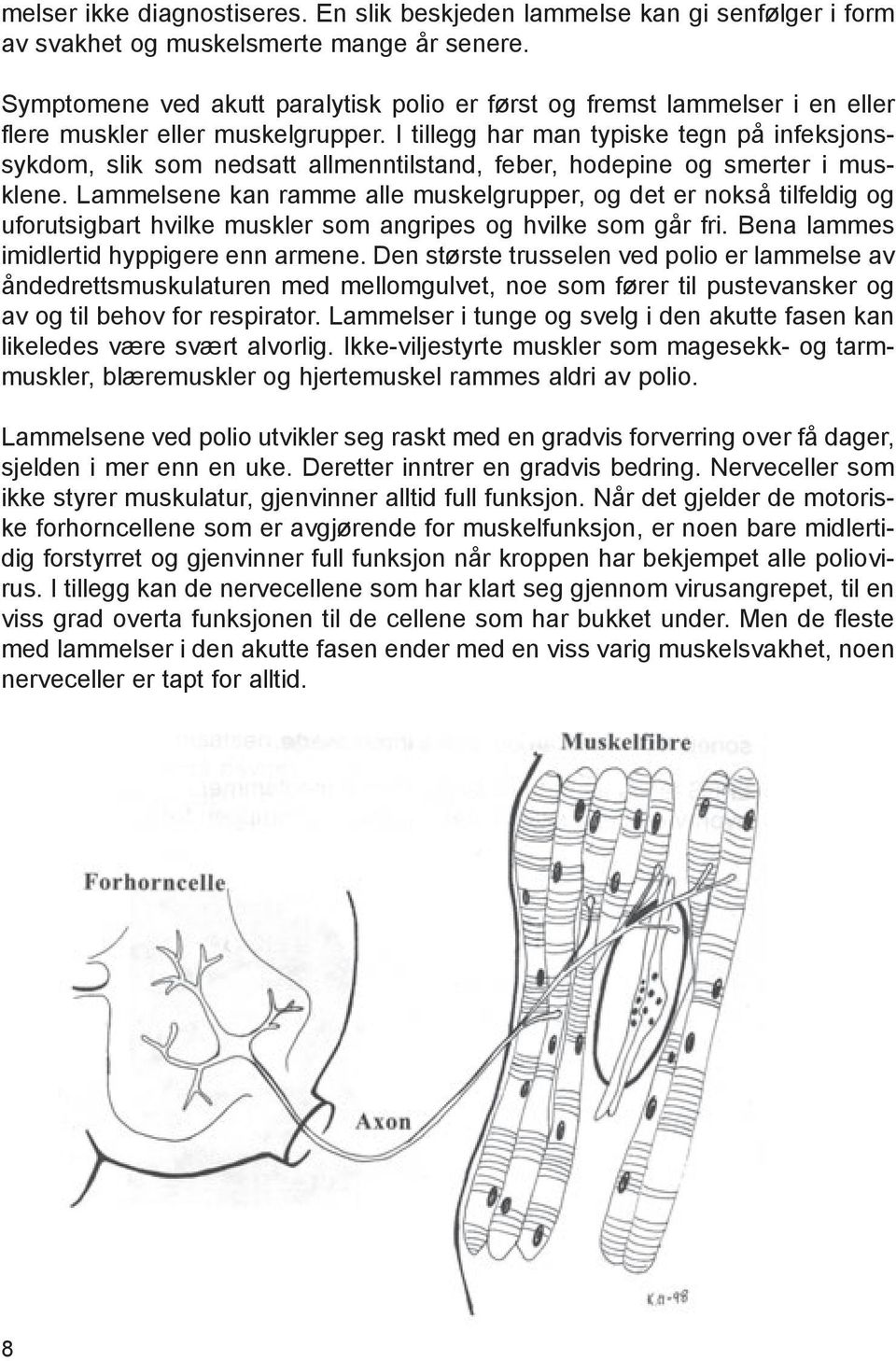 I tillegg har man typiske tegn på infeksjonssykdom, slik som nedsatt allmenntilstand, feber, hodepine og smerter i musklene.