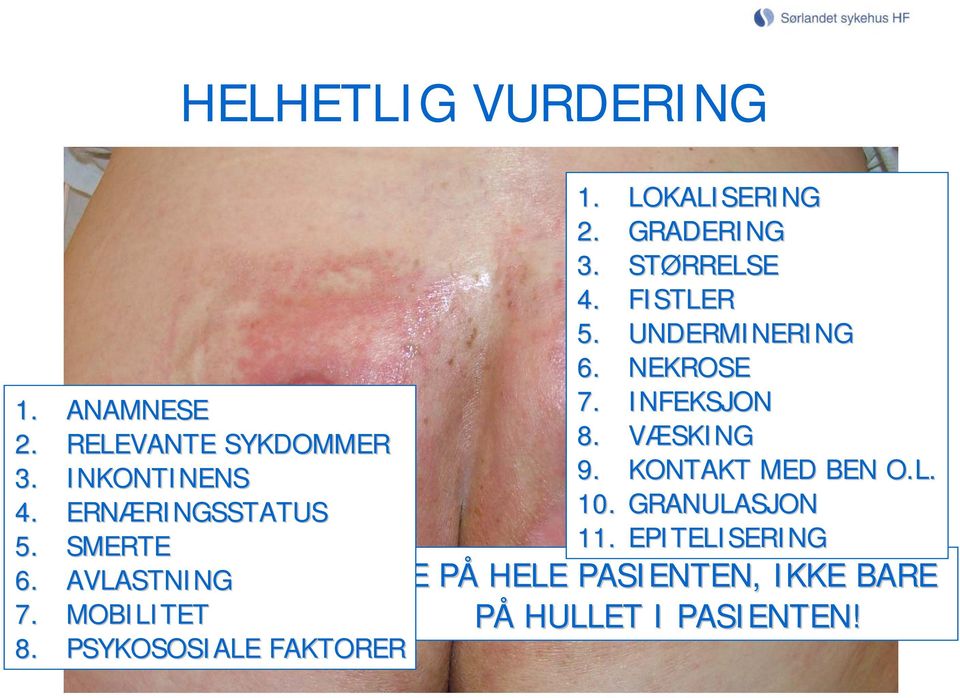 LOKALISERING 2. GRADERING 3. STØRRELSE 4. FISTLER 5. UNDERMINERING 6. NEKROSE 7. INFEKSJON 8.