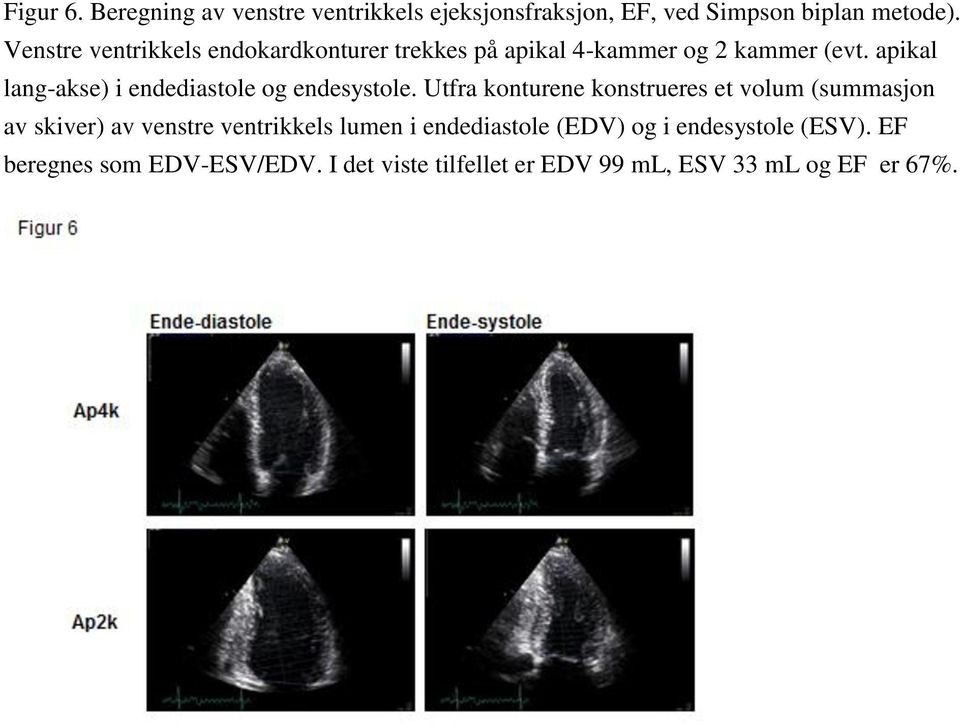 apikal lang-akse) i endediastole og endesystole.