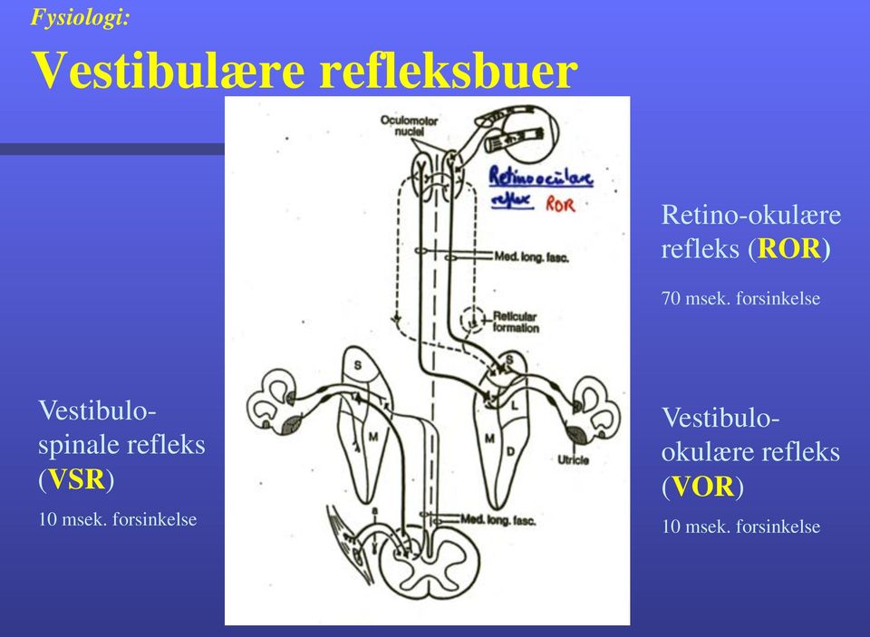 forsinkelse Vestibulospinale refleks (VSR) 10