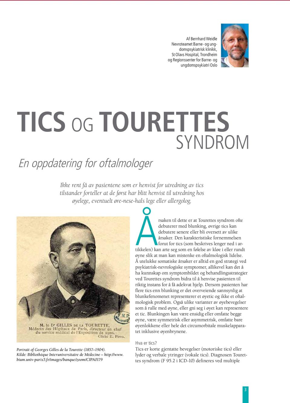allergolog. Årsaken til dette er at Tourettes syndrom ofte debuterer med blunking, øvrige tics kan debutere senere eller bli oversett av ulike årsaker.