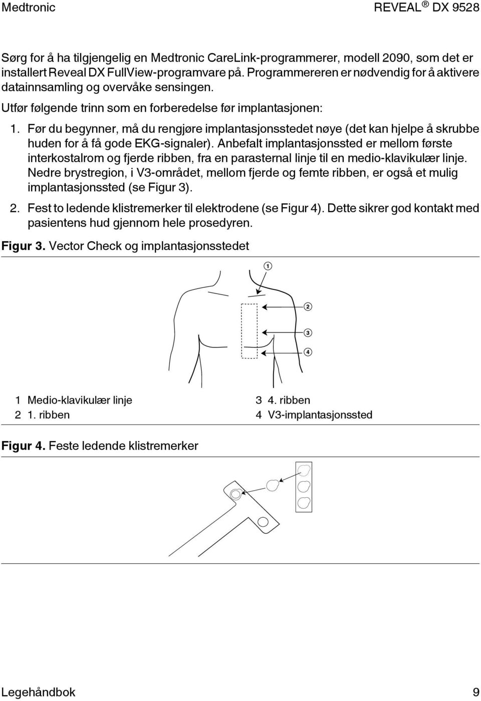 Før du begynner, må du rengjøre implantasjonsstedet nøye (det kan hjelpe å skrubbe huden for å få gode EKG-signaler).