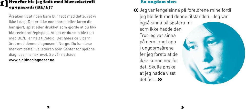 Det fødes ca 3 barn i året med denne diagnosen i Norge. Du kan lese mer om dette i veilederen som Senter for sjeldne diagnoser har skrevet. Se vår nettside www.sjeldnediagnoser.