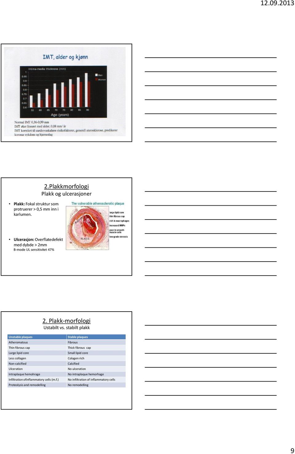 stabilt plakk Unstable plaques Atheromatous Thin fibrous cap Large lipid core Less collagen Non-calcified Ulceration Intraplaque hemohrage