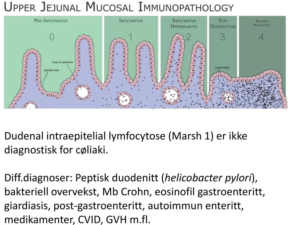diagnoser: Peptisk duodenitt (helicobacter pylori), bakteriell