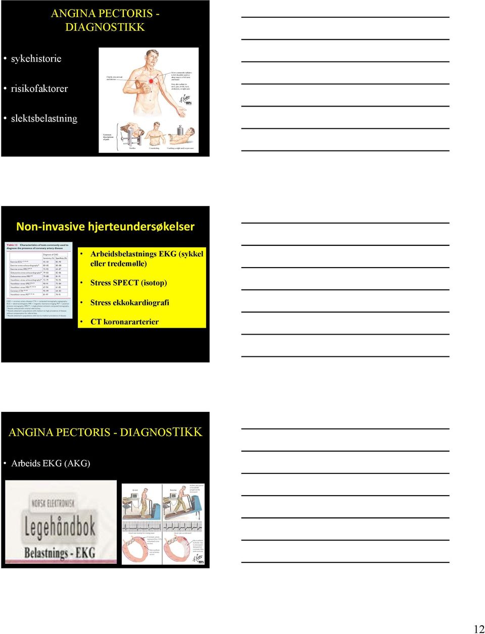 Arbeidsbelastnings EKG (sykkel eller tredemølle) Stress SPECT