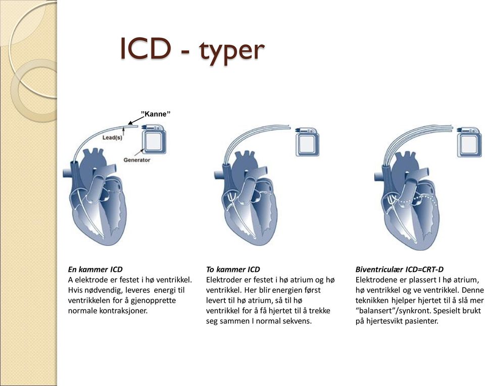 To kammer ICD Elektroder er festet i hø atrium og hø ventrikkel.
