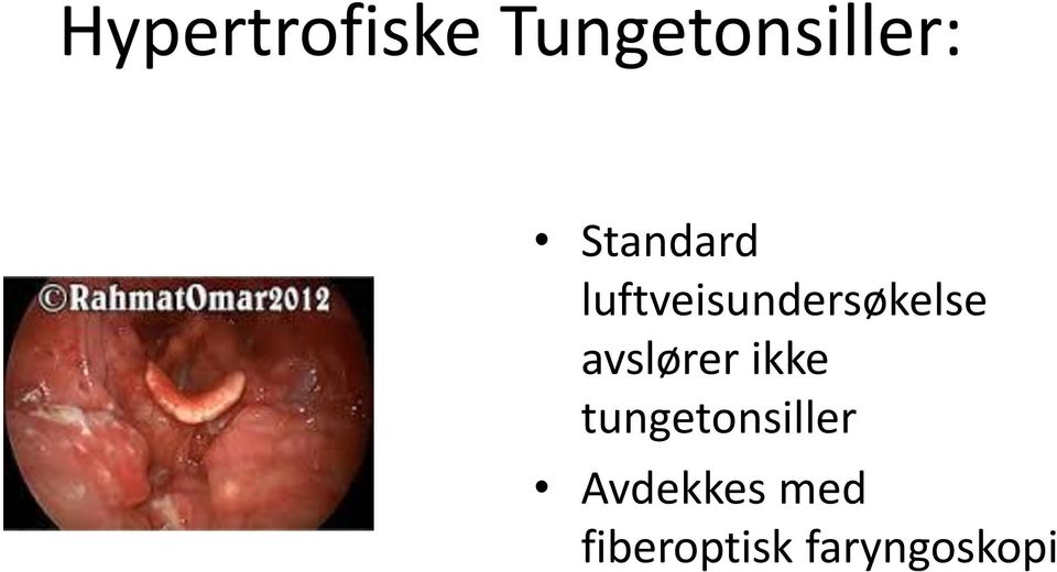 avslører ikke tungetonsiller