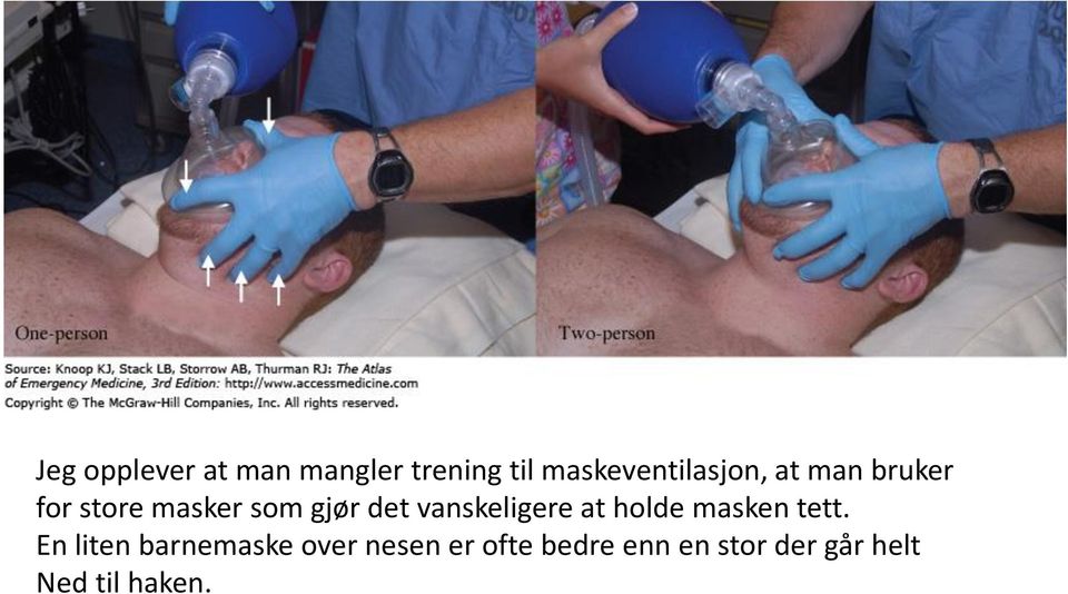 gjør det vanskeligere at holde masken tett.