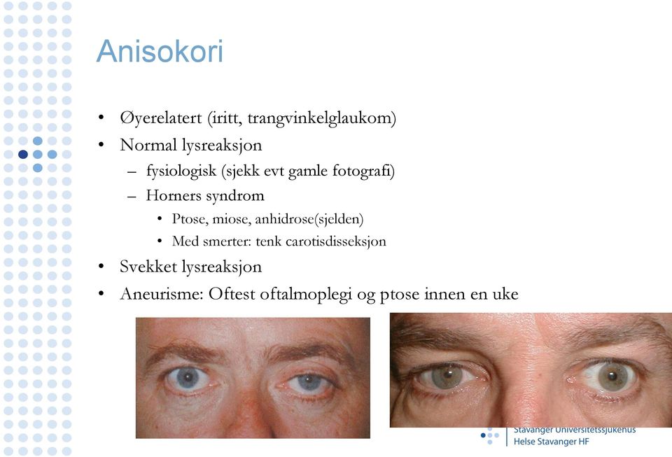 syndrom Ptose, miose, anhidrose(sjelden) Med smerter: tenk