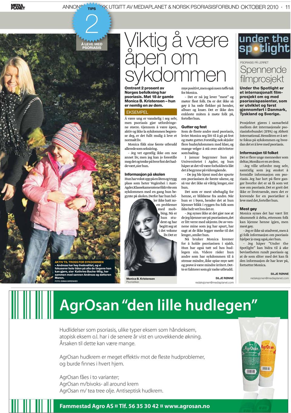 FOTO: EMMA WIRENHED Viktig å være åpen om sykdommen Omtrent 2 prosent av Norges befolkning har psoriasis. Møt 18 år gamle Monica B. Kristensen hun er nemlig en av dem.
