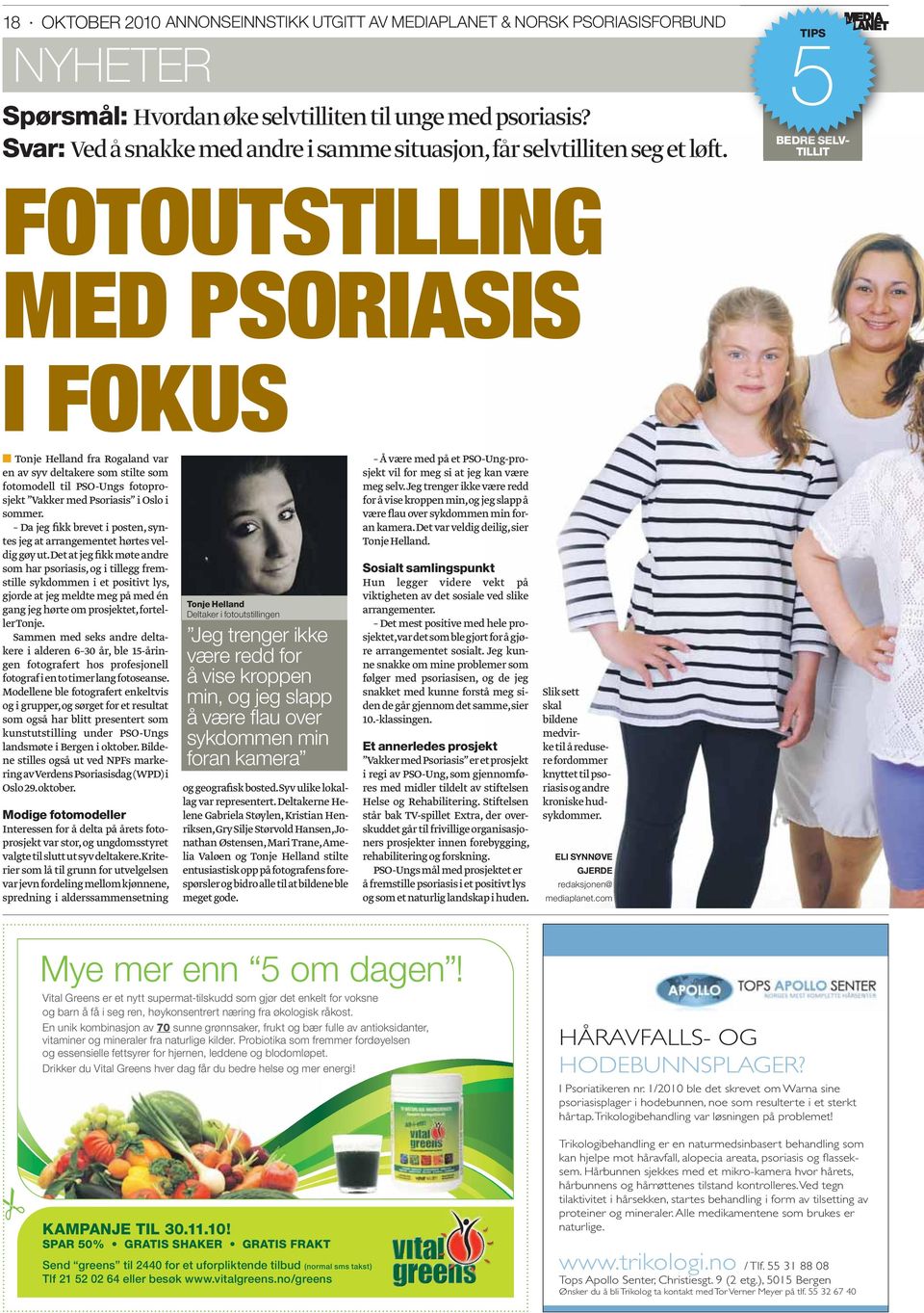 5TIPS BEDRE SELV- TILLIT FOTOUTSTILLING MED PSORIASIS I FOKUS Tonje Helland fra Rogaland var en av syv deltakere som stilte som fotomodell til PSO-Ungs fotoprosjekt Vakker med Psoriasis i Oslo i