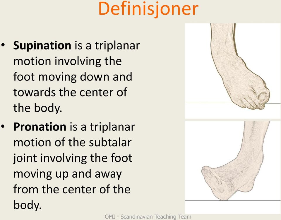 Pronation is a triplanar motion of the subtalar joint involving