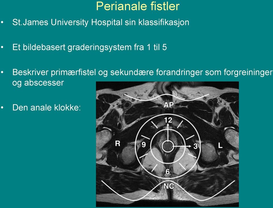 bildebasert graderingsystem fra 1 til 5 Beskriver