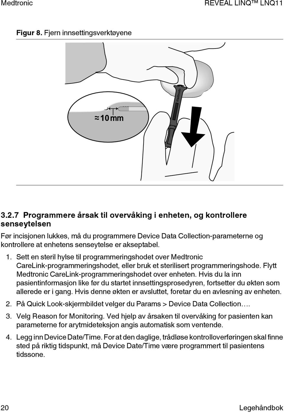 akseptabel. 1. Sett en steril hylse til programmeringshodet over Medtronic CareLink-programmeringshodet, eller bruk et sterilisert programmeringshode.