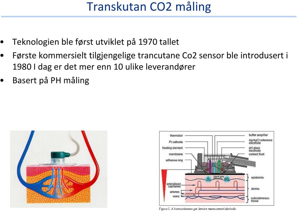 tilgjengelige trancutane Co2 sensor ble introdusert