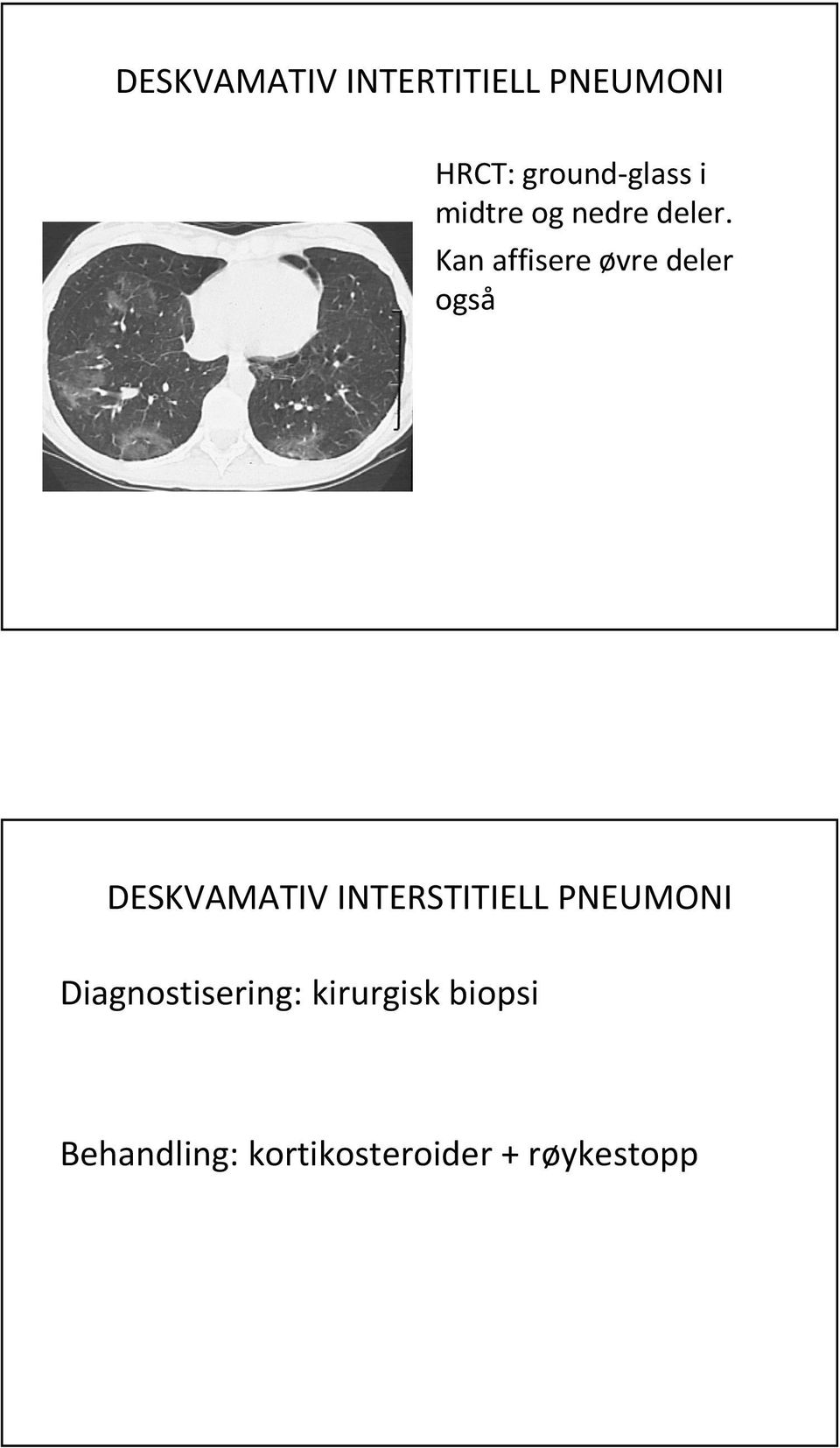 Kan affisere øvre deler også DESKVAMATIV INTERSTITIELL