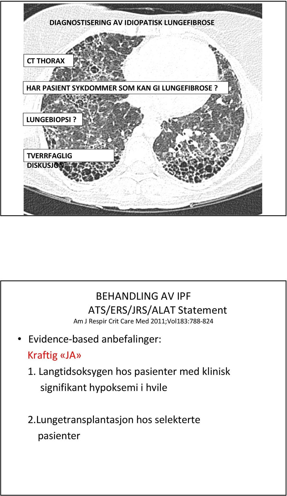 TVERRFAGLIG DISKUSJON BEHANDLING AV IPF ATS/ERS/JRS/ALAT Statement Am J Respir Crit Care Med