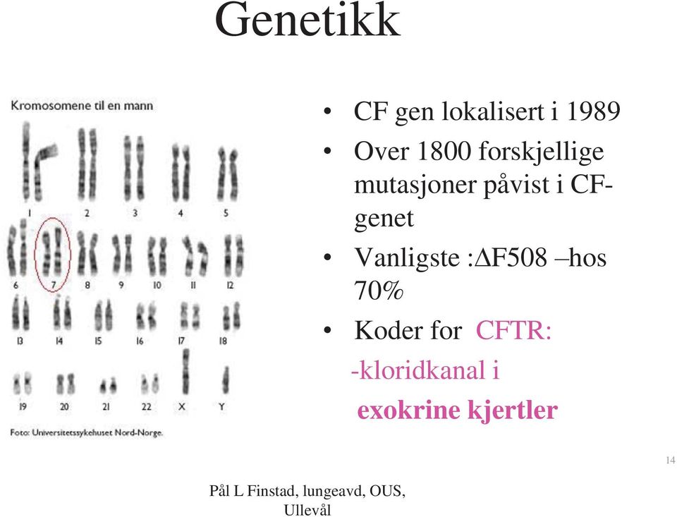 CFgenet Vanligste : F508 hos 70% Koder