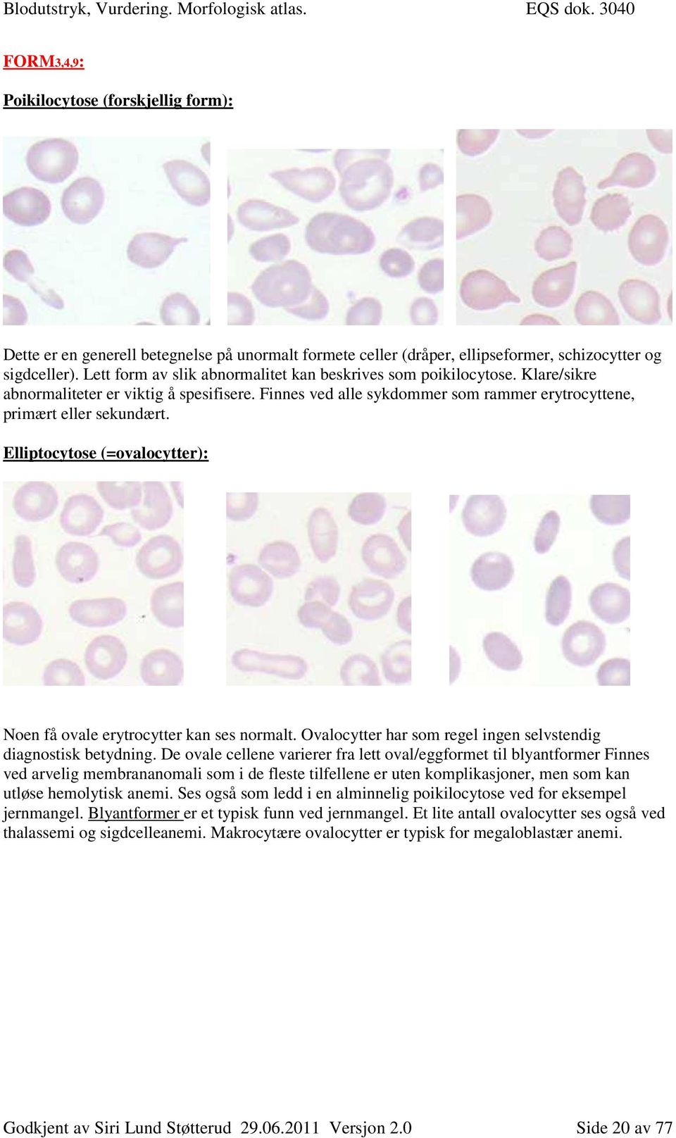 Elliptocytose (=ovalocytter): Noen få ovale erytrocytter kan ses normalt. Ovalocytter har som regel ingen selvstendig diagnostisk betydning.