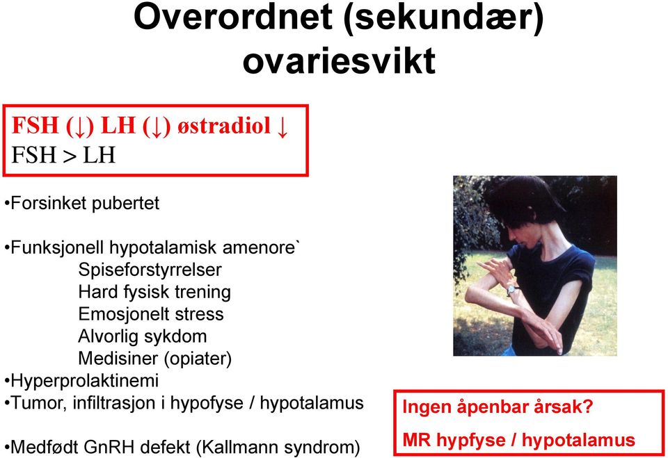 stress Alvorlig sykdom Medisiner (opiater) Hyperprolaktinemi Tumor, infiltrasjon i hypofyse /