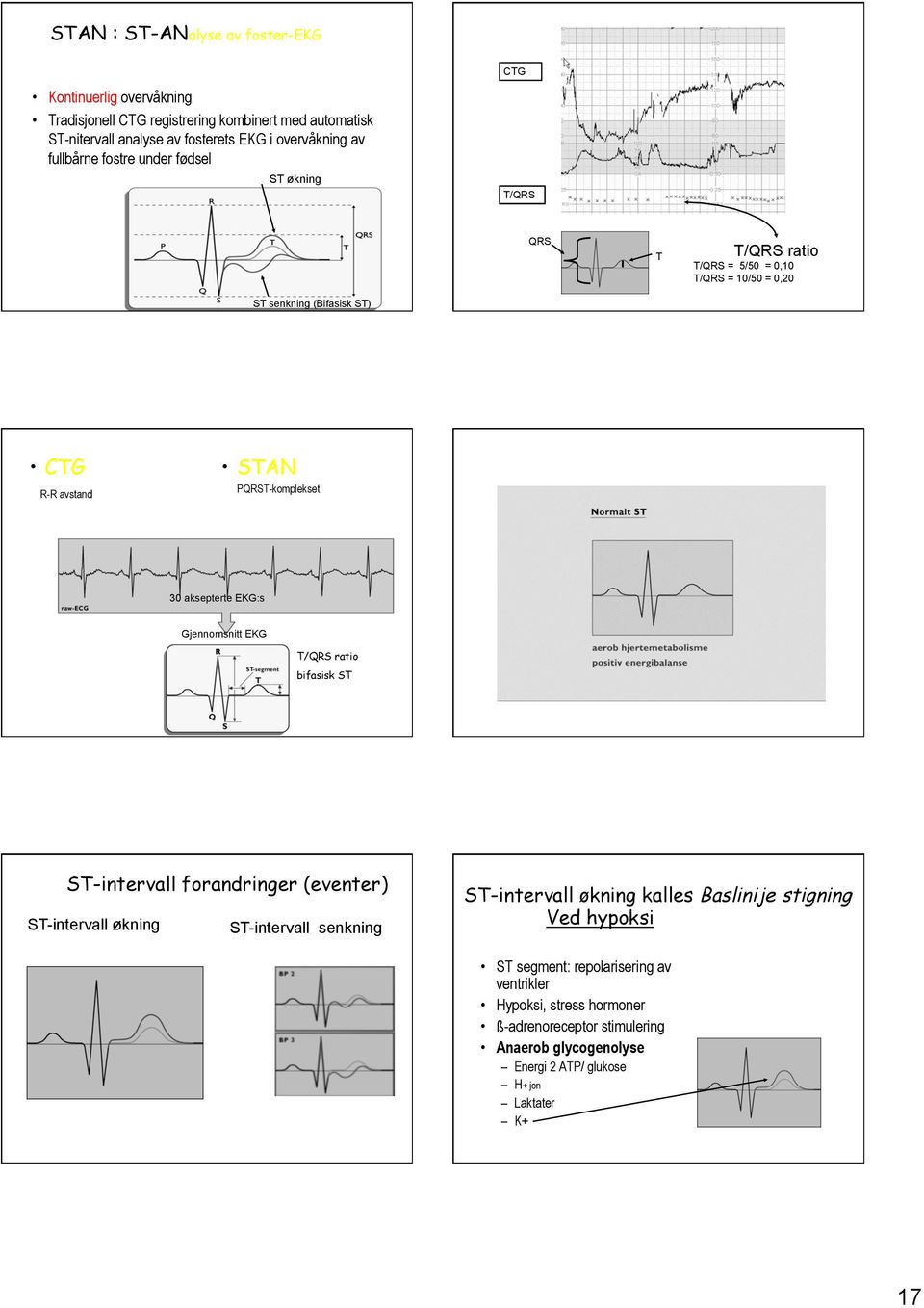 aksepterte EKG:s Gjennomsnitt EKG T/QRS ratio bifasisk ST ST-intervall forandringer (eventer) ST-intervall økning ST-intervall senkning ST-intervall økning kalles Baslinije