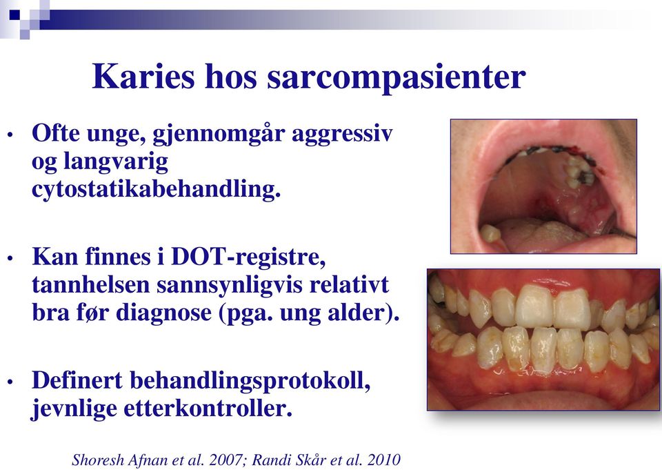 Kan finnes i DOT-registre, tannhelsen sannsynligvis relativt bra før