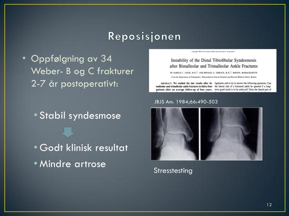 syndesmose JBJS Am.