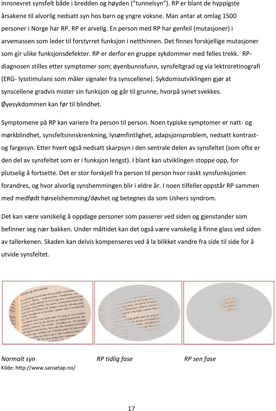 RP er derfor en gruppe sykdommer med felles trekk. RPdiagnosen stilles etter symptomer som; øyenbunnsfunn, synsfeltgrad og via lektroretinografi (ERG- lysstimulans som måler signaler fra synscellene).