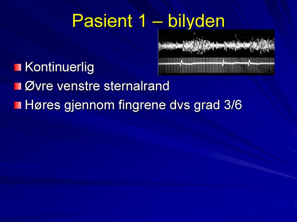 venstre sternalrand