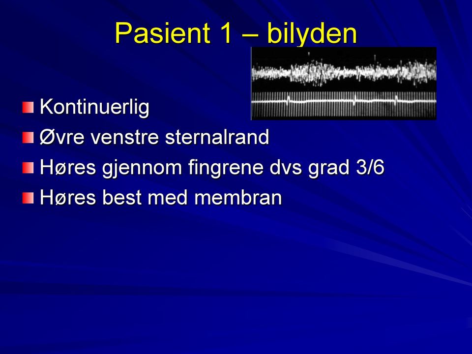 sternalrand Høres gjennom