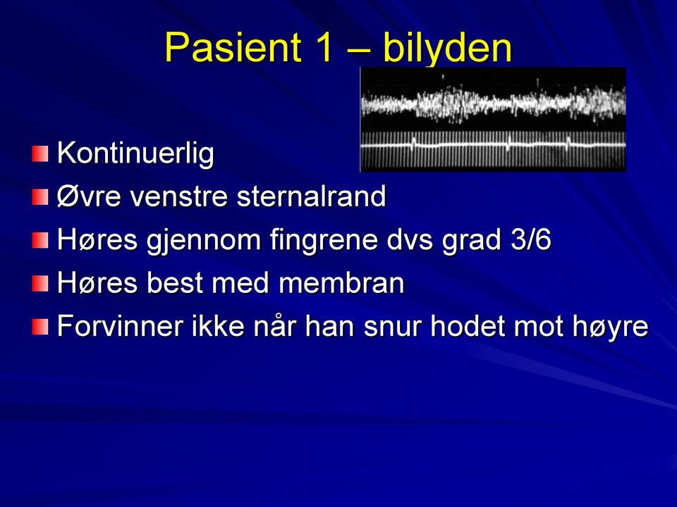 fingrene dvs grad 3/6 Høres best med