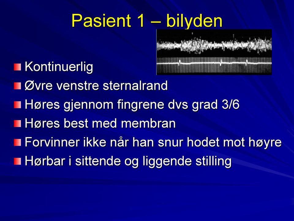 Høres best med membran Forvinner ikke når han