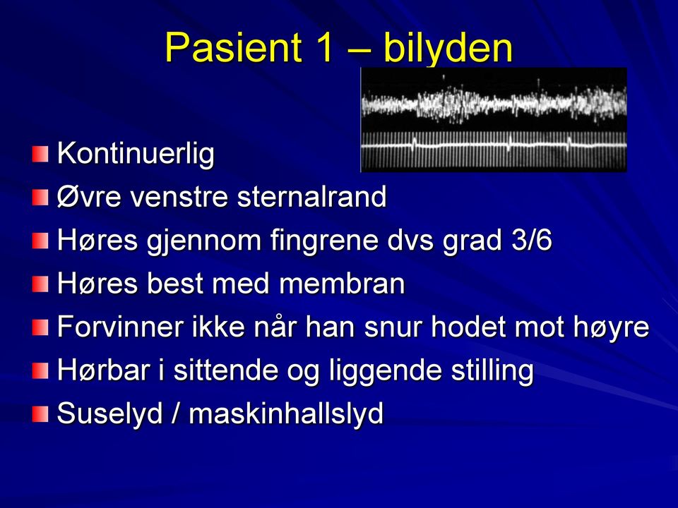 membran Forvinner ikke når han snur hodet mot høyre