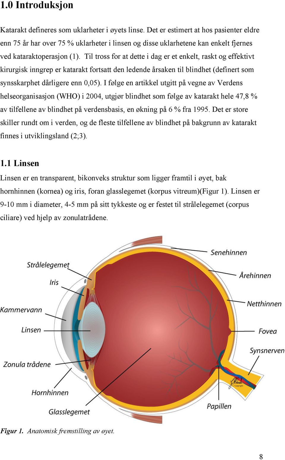 Til tross for at dette i dag er et enkelt, raskt og effektivt kirurgisk inngrep er katarakt fortsatt den ledende årsaken til blindhet (definert som synsskarphet dårligere enn 0,05).