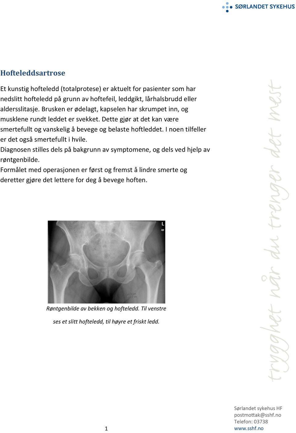 I noen tilfeller er det også smertefullt i hvile. Diagnosen stilles dels på bakgrunn av symptomene, og dels ved hjelp av røntgenbilde.