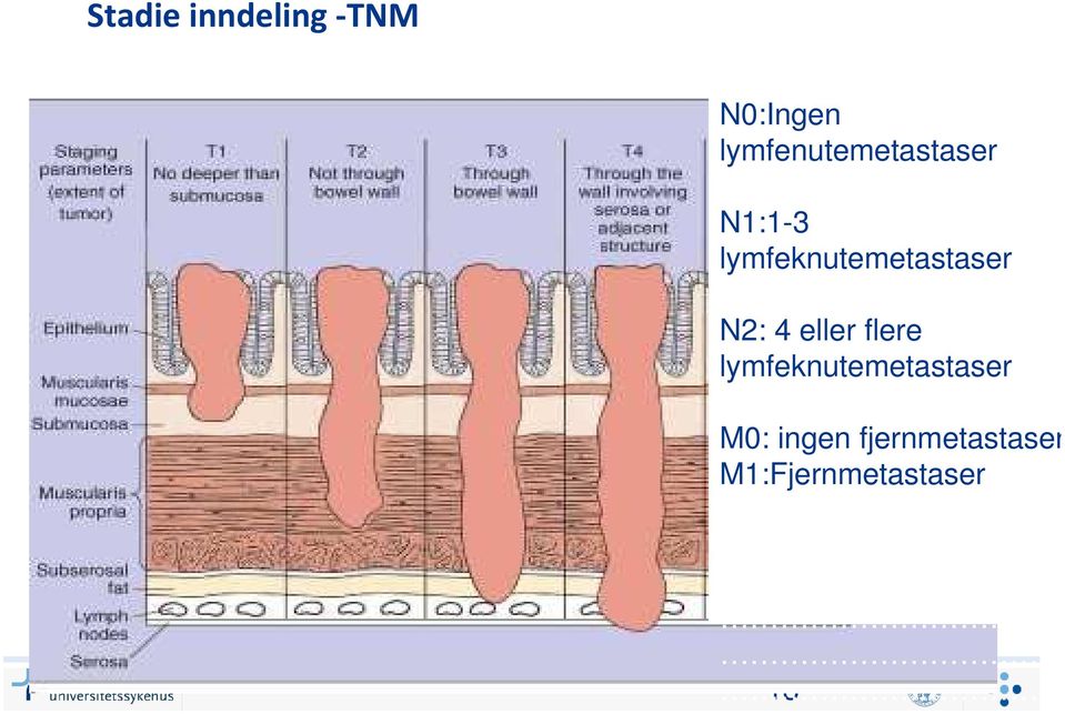 lymfeknutemetastaser N2: 4 eller flere